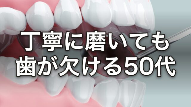 丁寧に磨いても歯が欠ける50代 原因は歯並び